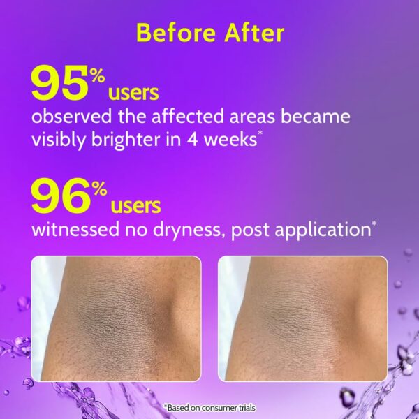Chemist at Play Brightening Roll-On for Neck, Knee & Elbow | 6% Vitamin C, Niacinamide, AHA & Ceramides | Fades Pigmentation & Hydrates Dry Skin | 40ml - Image 4
